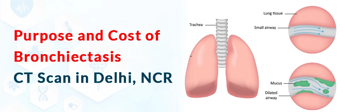 Purpose and Cost of Bronchiectasis CT Scan in Delhi, NCR